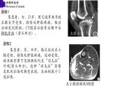 5.2.1+动物的运动-【精华备课】2023-2024学年八年级生物上册同步教学课件（人教版）