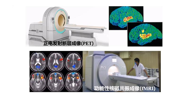 2.1.1 神经系统的组成（第二课时）-2023-2024学年八年级生命科学同步课堂（沪教版第一册）课件03