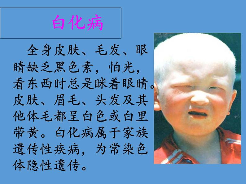 苏教版生物八年级下册 第二十二章 第四节 遗传病和优生优育(8)-课件第6页