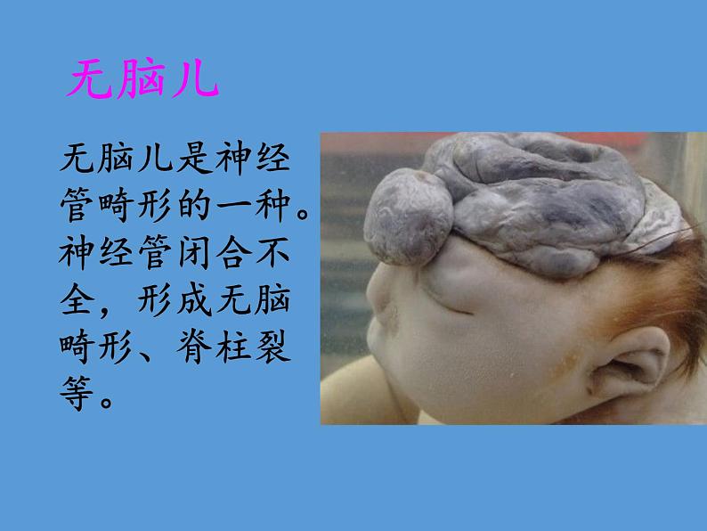 苏教版生物八年级下册 第二十二章 第四节 遗传病和优生优育(8)-课件第7页