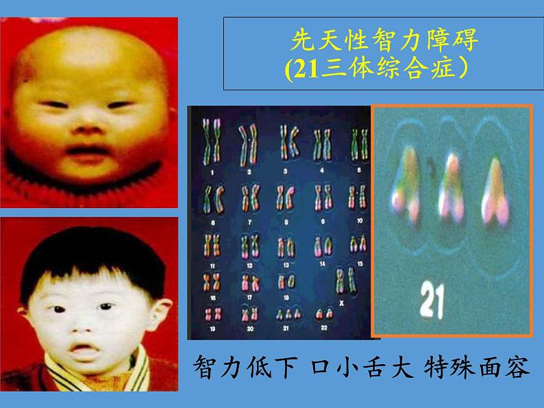 苏教版生物八年级下册 第二十二章 第四节 遗传病和优生优育(8)-课件第8页