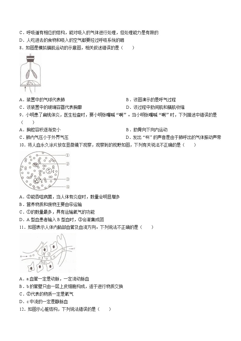 山东省临沂市兰山区2021-2022学年七年级下学期期末质量检测生物试卷02
