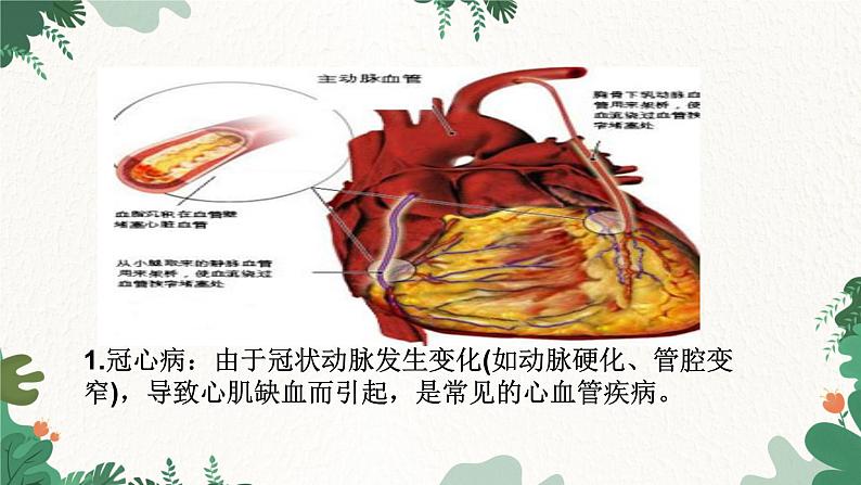 北师大版生物七年级下册 第13章 第4节 《当代主要疾病和预防》课件03