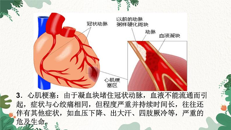 北师大版生物七年级下册 第13章 第4节 《当代主要疾病和预防》课件05