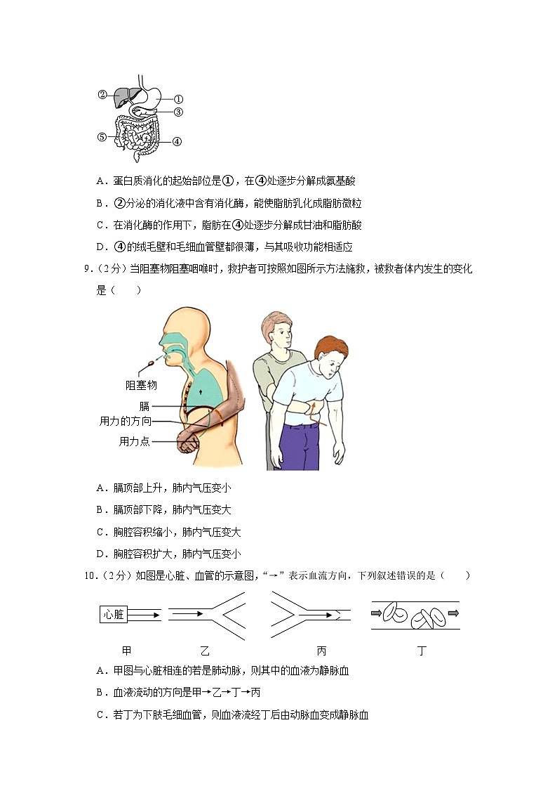 2023年湖北省十堰市丹江口市中考生物适应性试卷+03