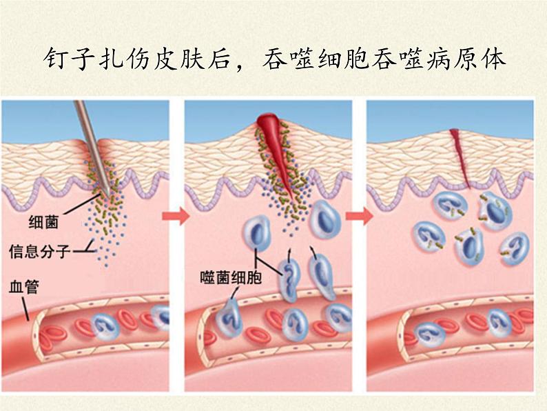 北师大版生物七年级下册 第13章 第3节 人体免疫(2)（课件）06