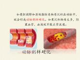 北师大版生物七年级下册 第13章 第4节 当代主要疾病和预防(2)（课件）