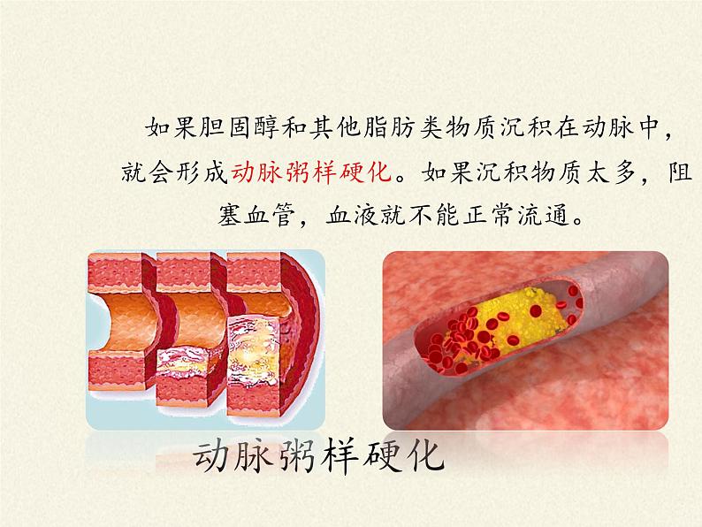 北师大版生物七年级下册 第13章 第4节 当代主要疾病和预防(2)（课件）第4页