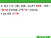 【新课标】北师大版生物七下11.3《皮肤与汗液分泌》课件