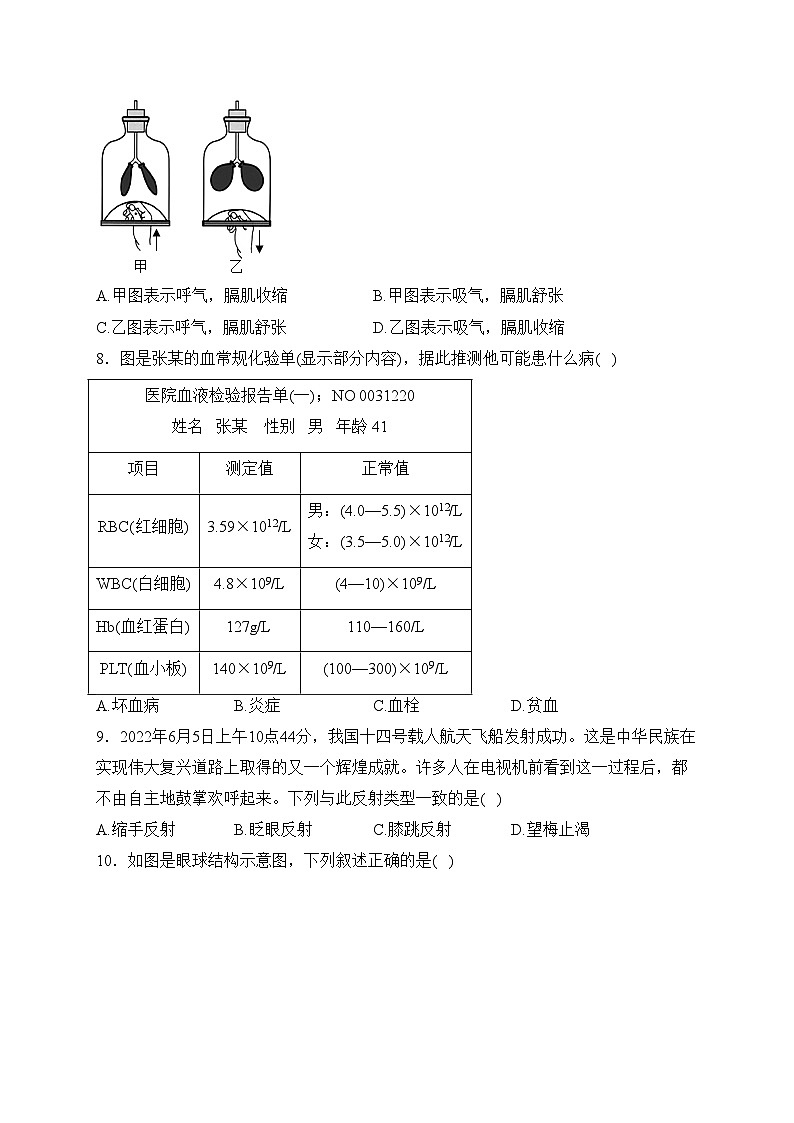 河南省开封市通许县2023届九年级下学期中考一模生物试卷(含答案)第3页