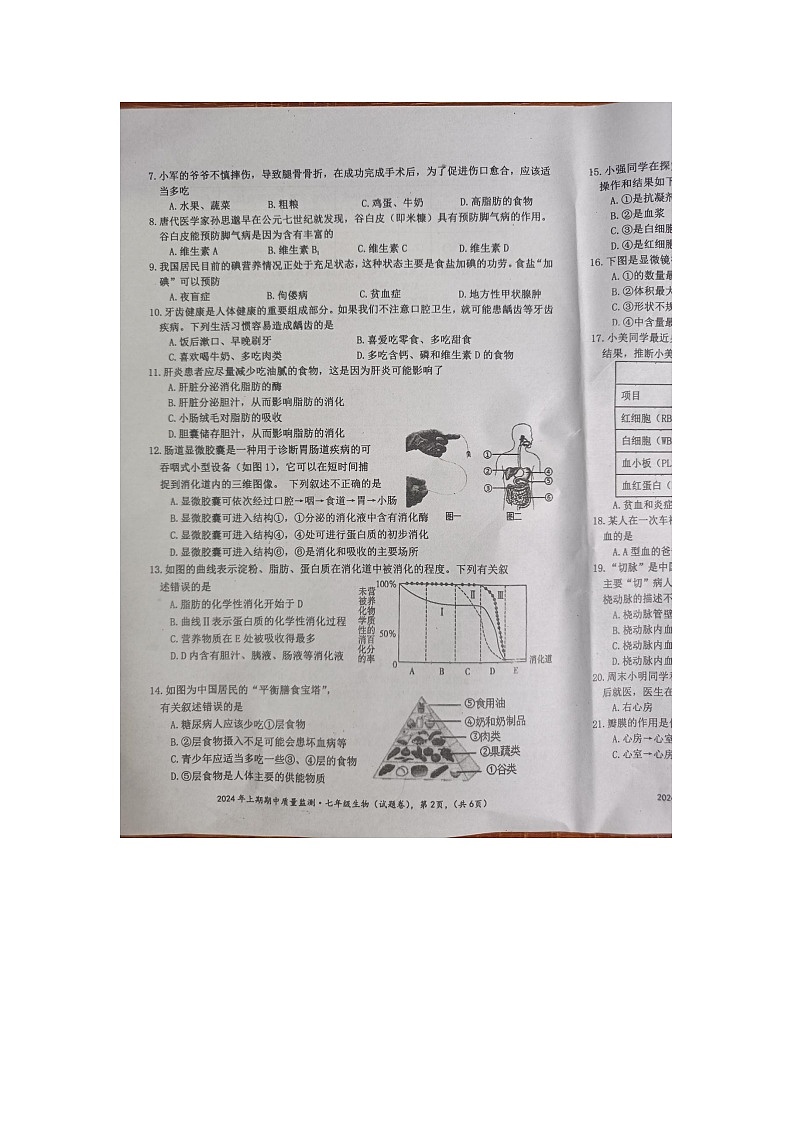 湖南省永州市新田县2023-2024学年七年级下学期4月期中生物试题02