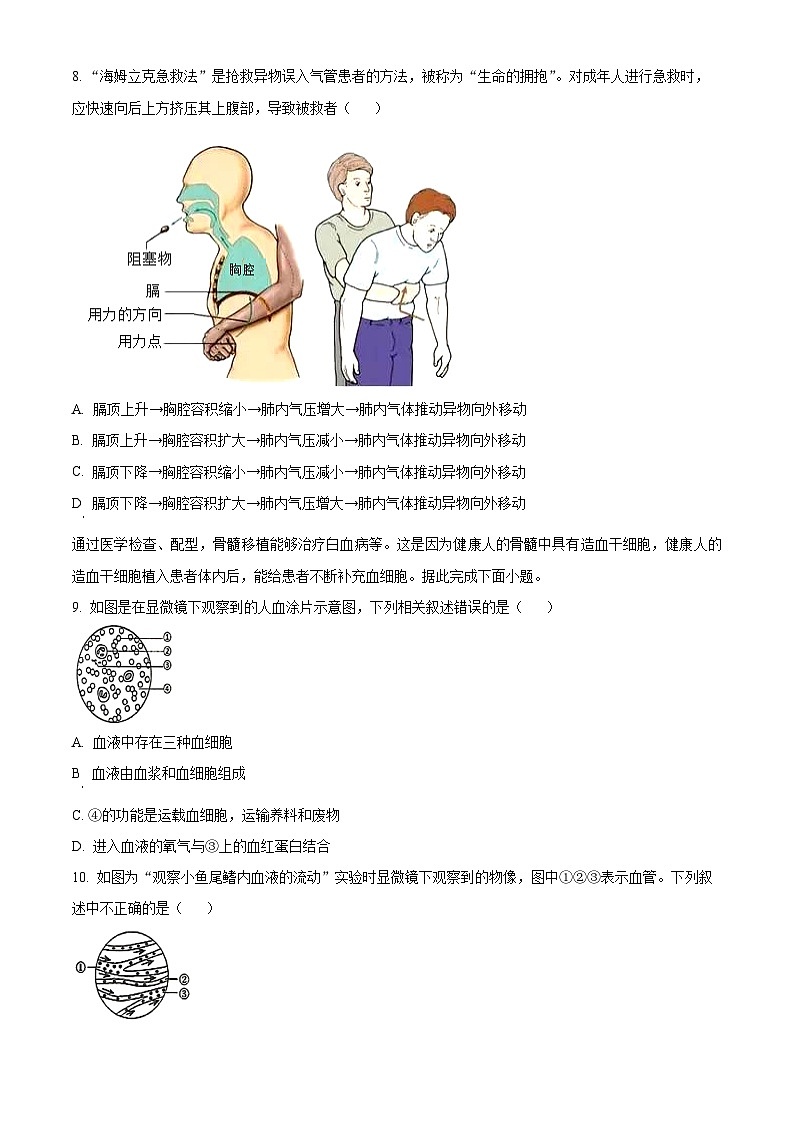 湖北省黄石市大冶市2023-2024学年七年级下学期期中生物试题（原卷版）第3页