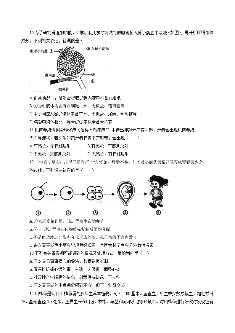 2024年四川省成都市高新区初中学业水平考试科目模拟考试生物试卷（含答案）第3页