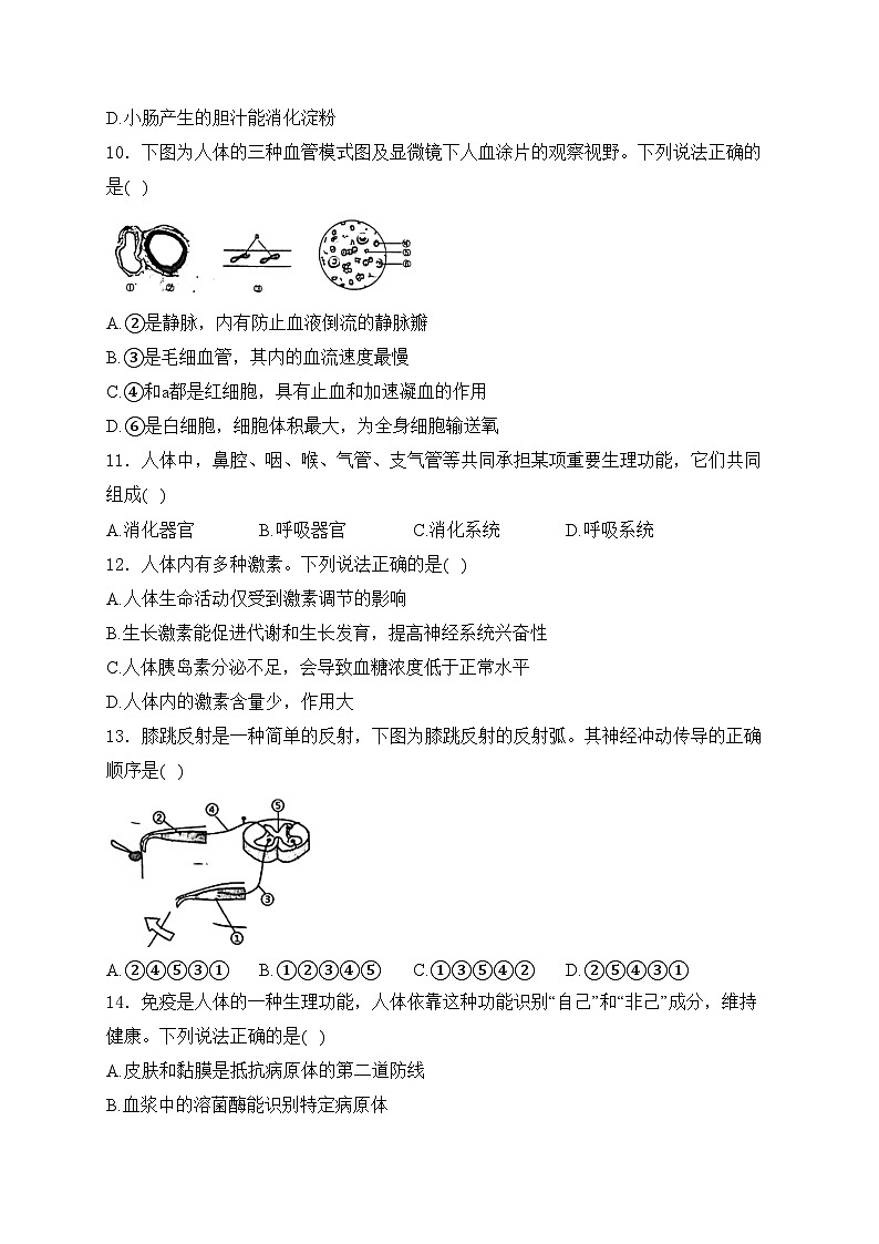 河北省石家庄市2024年初中毕业班中考一模生物试卷(含答案)03