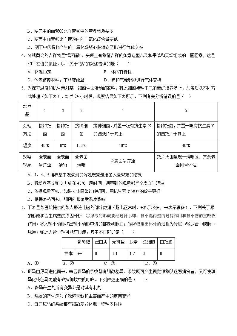 2024年中考押题预测卷（湖北卷）生物（考试版）A402