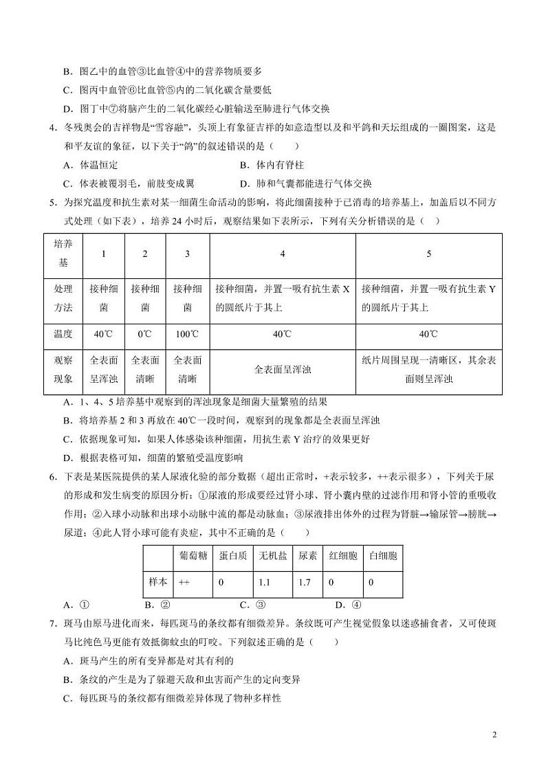 2024年中考押题预测卷（湖北卷）生物（考试版）02