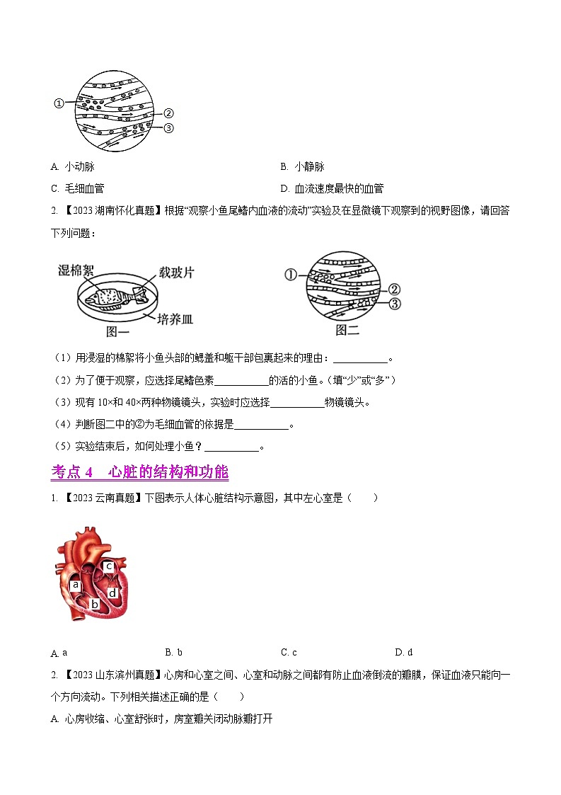 2024年中考生物真题分项汇编（全国通用）-专题09  人体内物质的运输-学易金卷：（第1期）（原卷版）第3页
