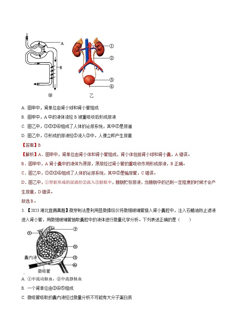 2024年中考生物真题分项汇编（全国通用）-专题10  人体内废物的排出-学易金卷：（第1期）（解析版）第2页