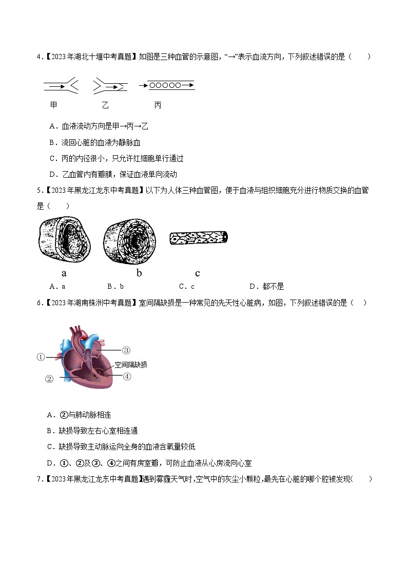 2024年中考生物真题分项汇编（全国通用）-专题07 人体内物质的运输（原卷版+解析版）03