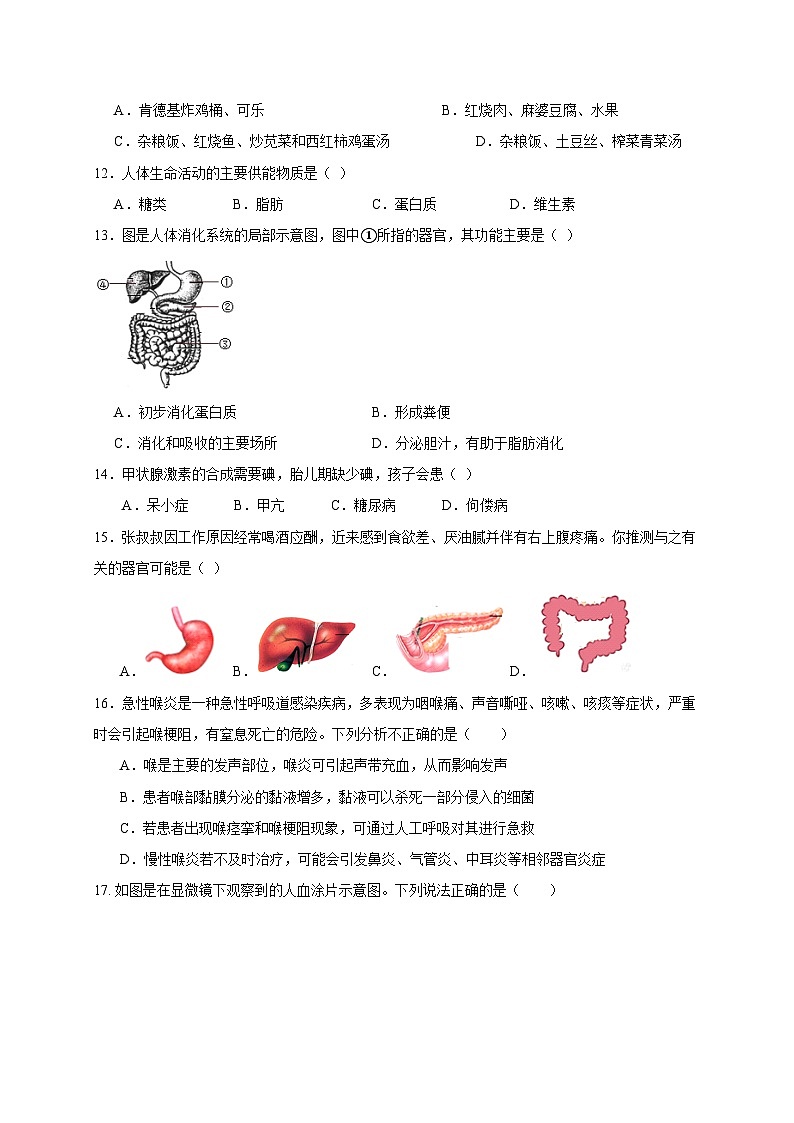 25，湖南省永州市道县2023-2024学年七年级下学期期中考试生物试题03
