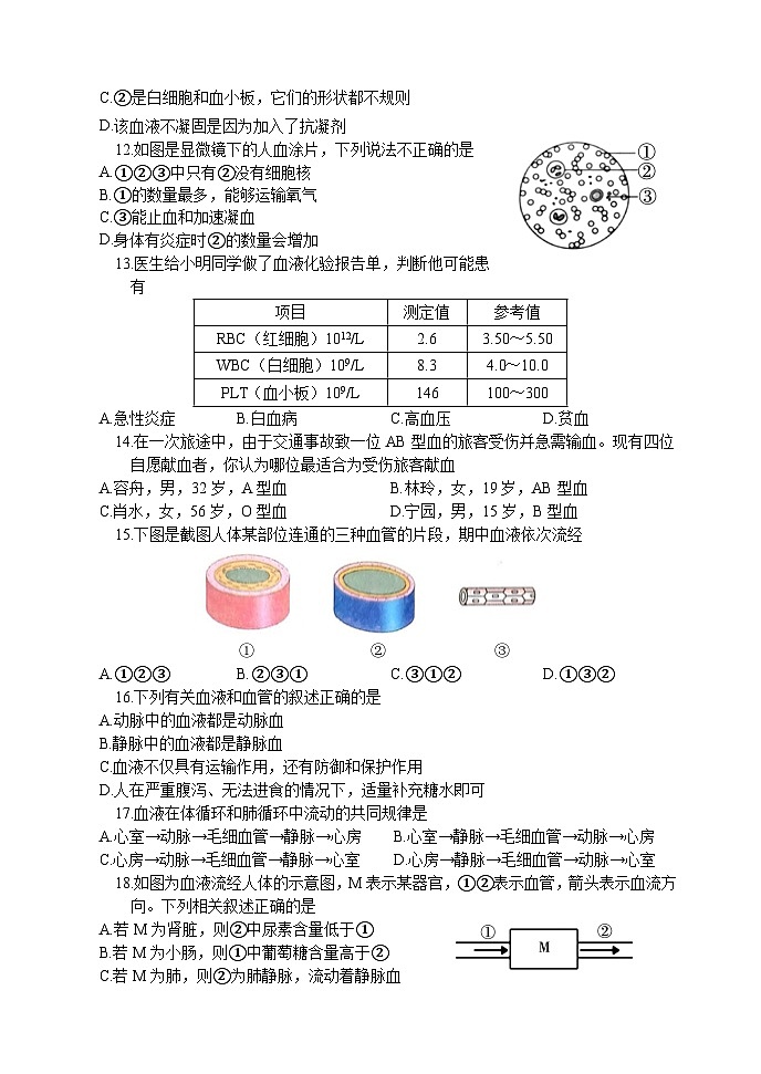 71，山东省菏泽市东明县2023-2024学年七年级下学期期中考试生物试题03