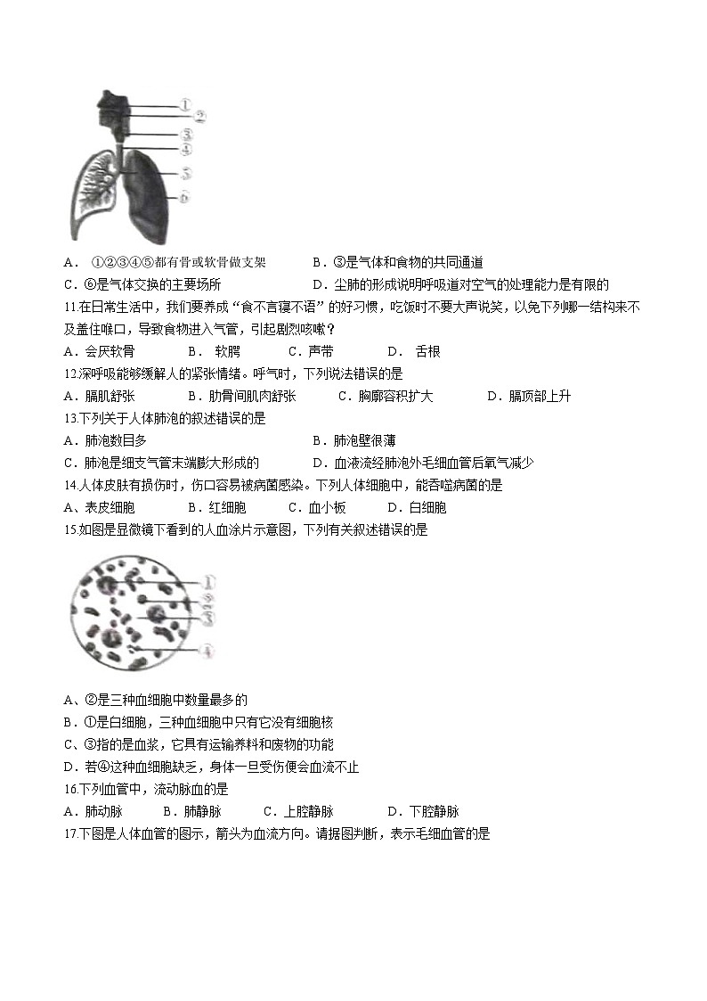 13，山西省忻州市静乐县第二中学2023-2024学年七年级下学期期中生物试题(无答案)03