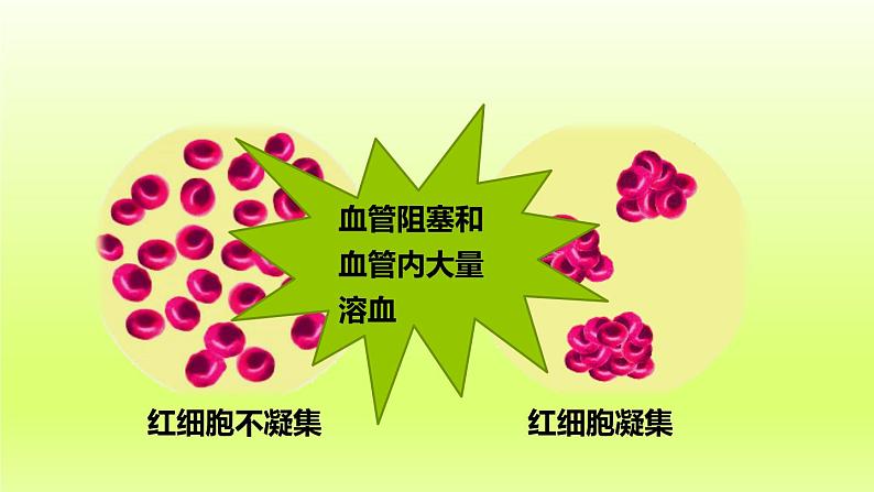 七下生物第四单元生物圈中的人第四章人体内物质的运输第四节输血与血型课件（人教版）07