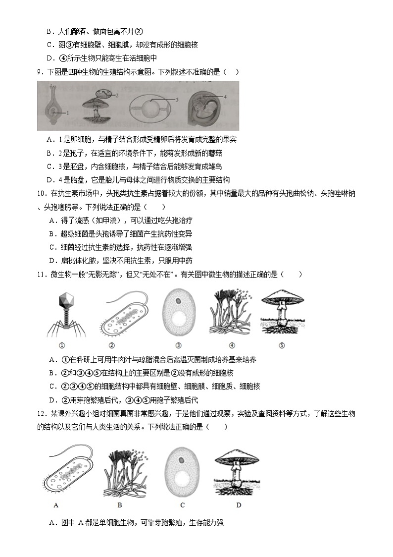 2024年中考生物考前必刷题之生物圈中的微生物（山东专用）（原卷版）第3页