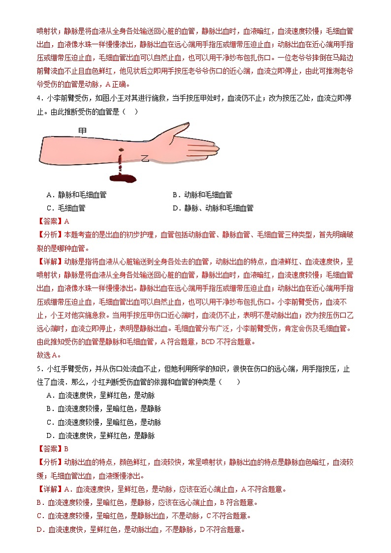 2024年山东省中考生物复习冲刺：近心端还是远心端及识别血管（山东专用）（原卷版＋解析版）02