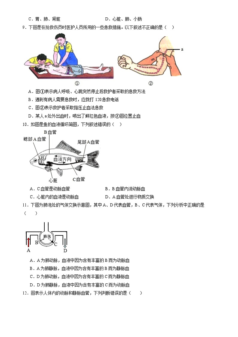 2024年山东省中考生物复习冲刺：近心端还是远心端及识别血管（山东专用）（原卷版＋解析版）02