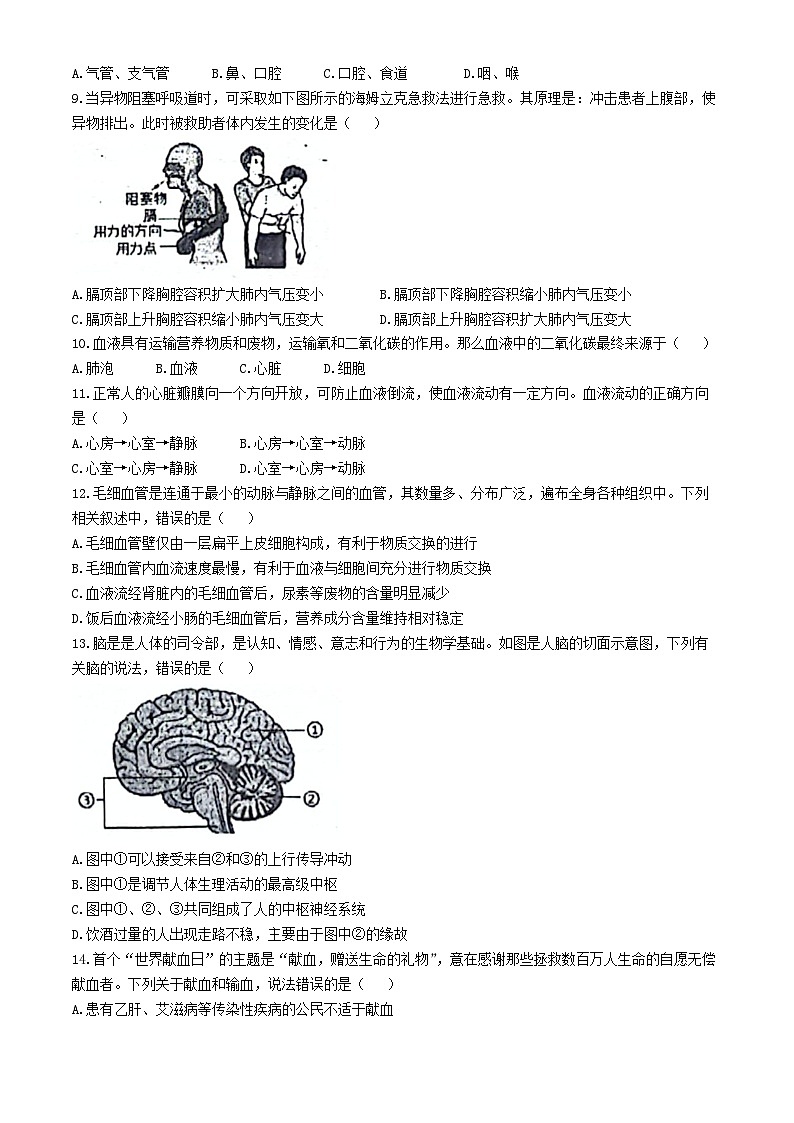 河南省新郑市2023-2024学年七年级下学期6月期末生物试题02