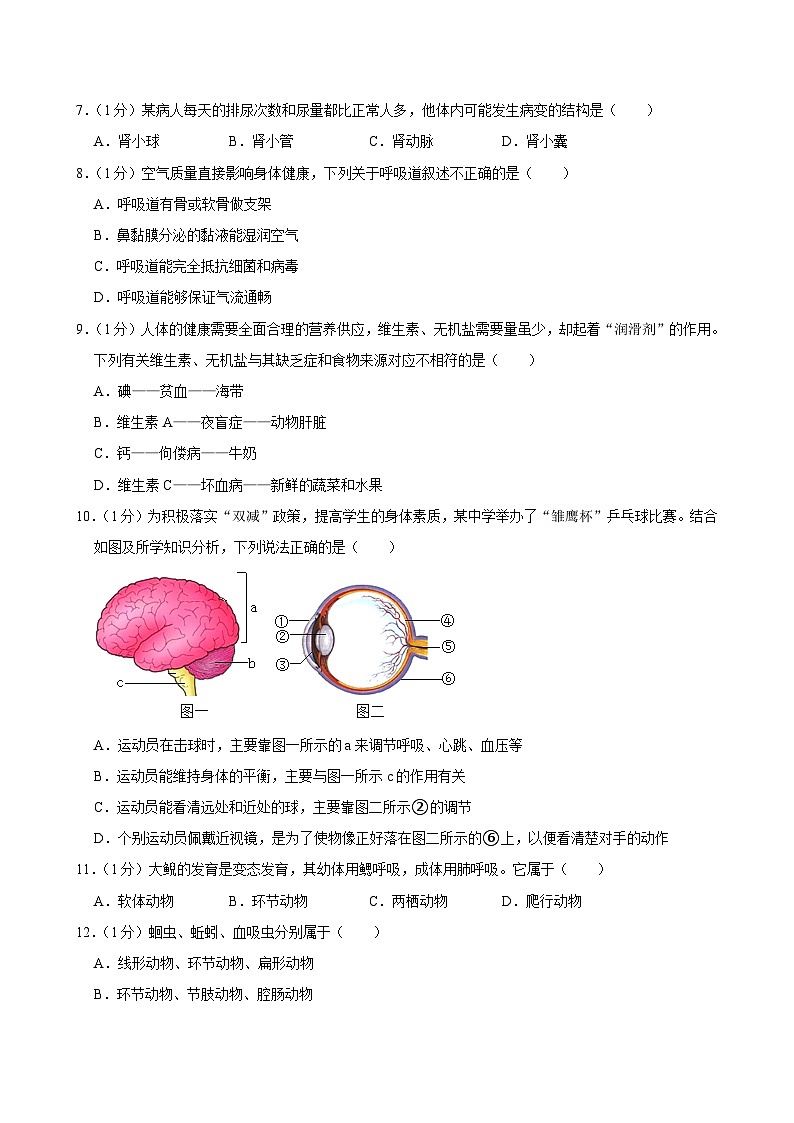 2024年吉林省长春市榆树市中考考前模拟预测生物试题第2页