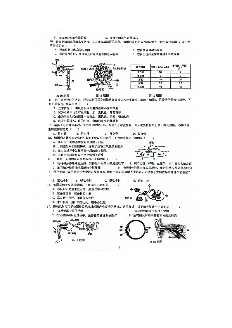 安徽省淮南市淮南实验中学2023-2024学年七年级下学期期末学情检测生物试卷02