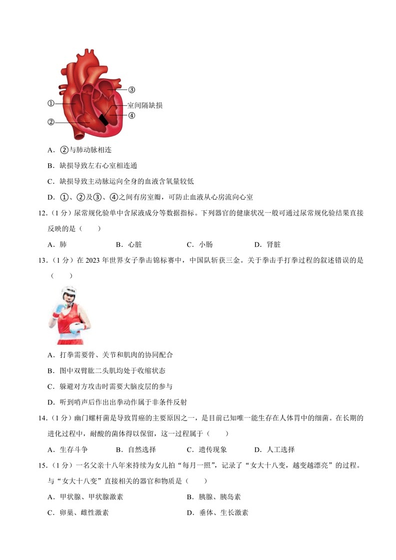 [生物][一模]2024年河南省开封市中考试卷(有解析)03