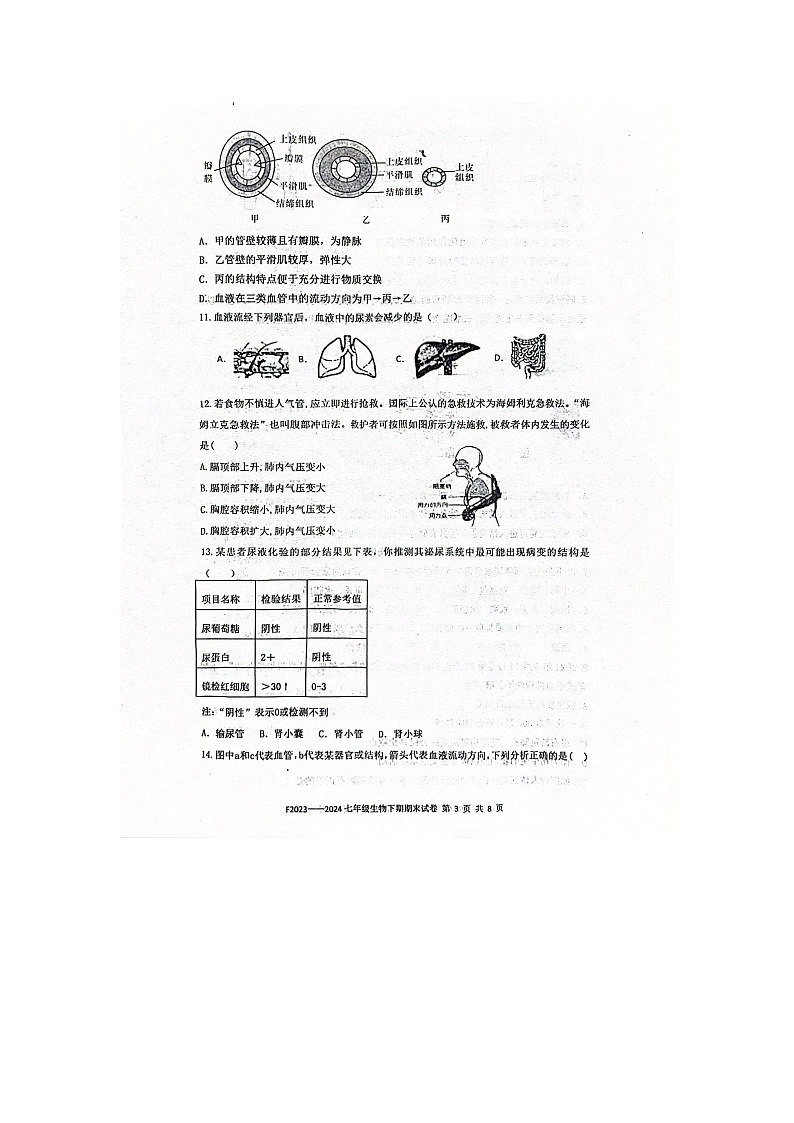 河南省周口市扶沟县2023-2024学年七年级下学期7月期末生物试题第3页