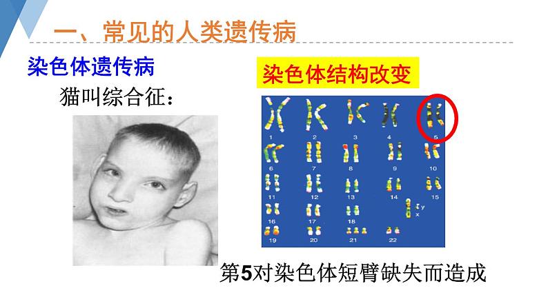 4.4.5 人类优生与基因组计划 课件 --2024年初中秋季济南版生物八年级上册08