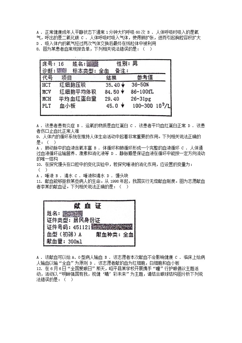 [生物][期末]广西壮族自治区贺州市昭平县2023-2024学年七年级下学期生物期末试卷第2页