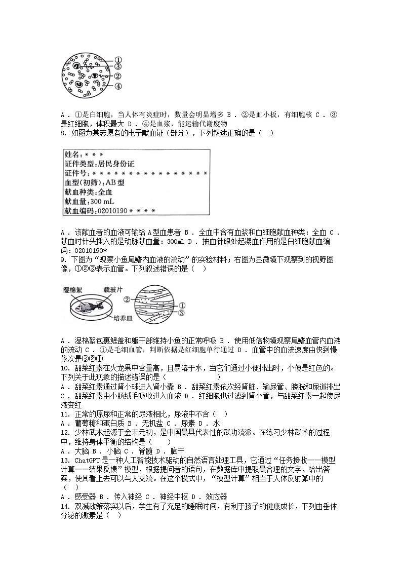 [生物][期末]广西壮族自治区玉林市玉州区2023-2024学年七年级下学期生物期末试卷02