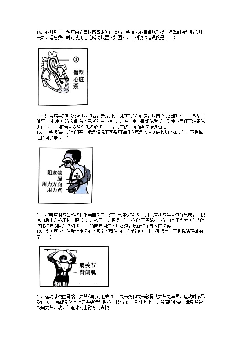 [生物][三模]湖南省株洲市2024年中考三模生物试卷03
