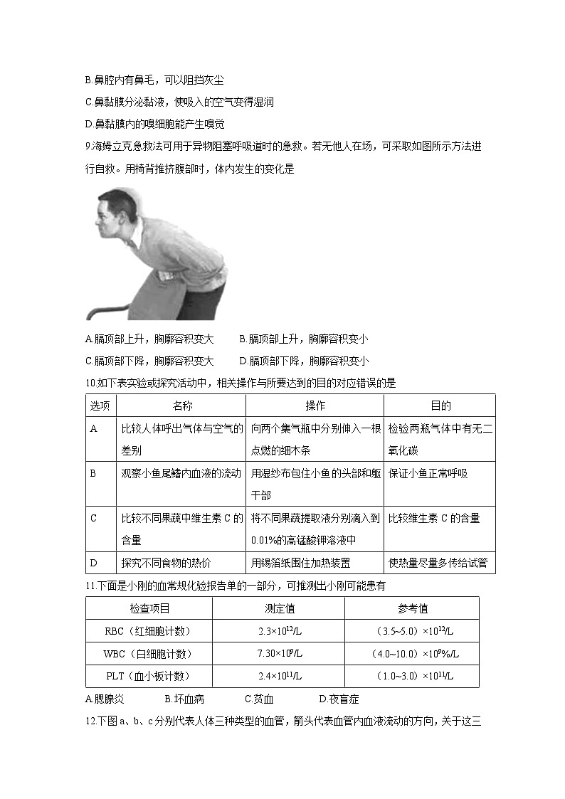 [生物][期末]四川省广安市邻水县2023-2024学年七年级下学期7月期末试题03