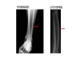 苏科版八上生物 17.1 《人体的运动》（一）课件