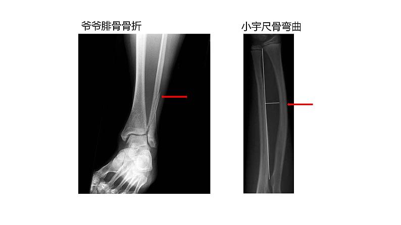 苏科版八上生物 17.1 《人体的运动》（一）课件05