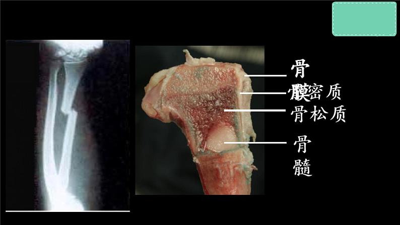 冀少版生物八上 1.1《运动的基础》课件07