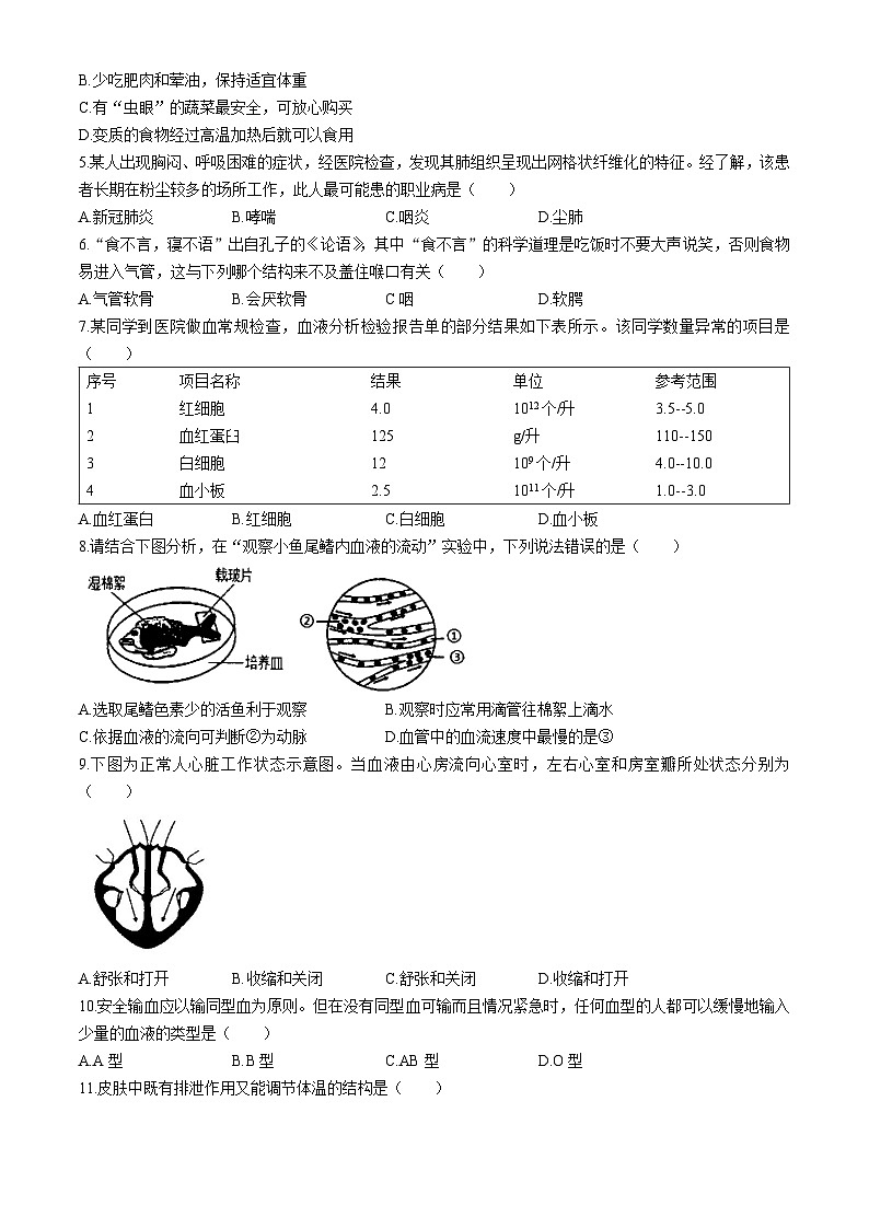 广西壮族自治区梧州市2023-2024学年七年级下学期期末考试生物试题(无答案)02