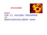 2.3.4病毒  课件2024-2025学年人教版（2024）生物七年级上册