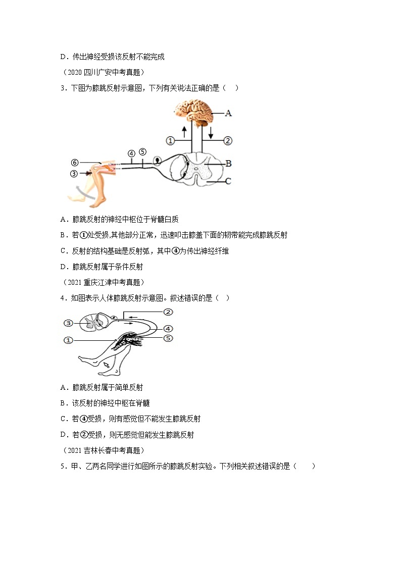 16 7.6.3探究膝跳反射-七年级实验-2024-2025学年度初中生物微专题实验探索学案第3页