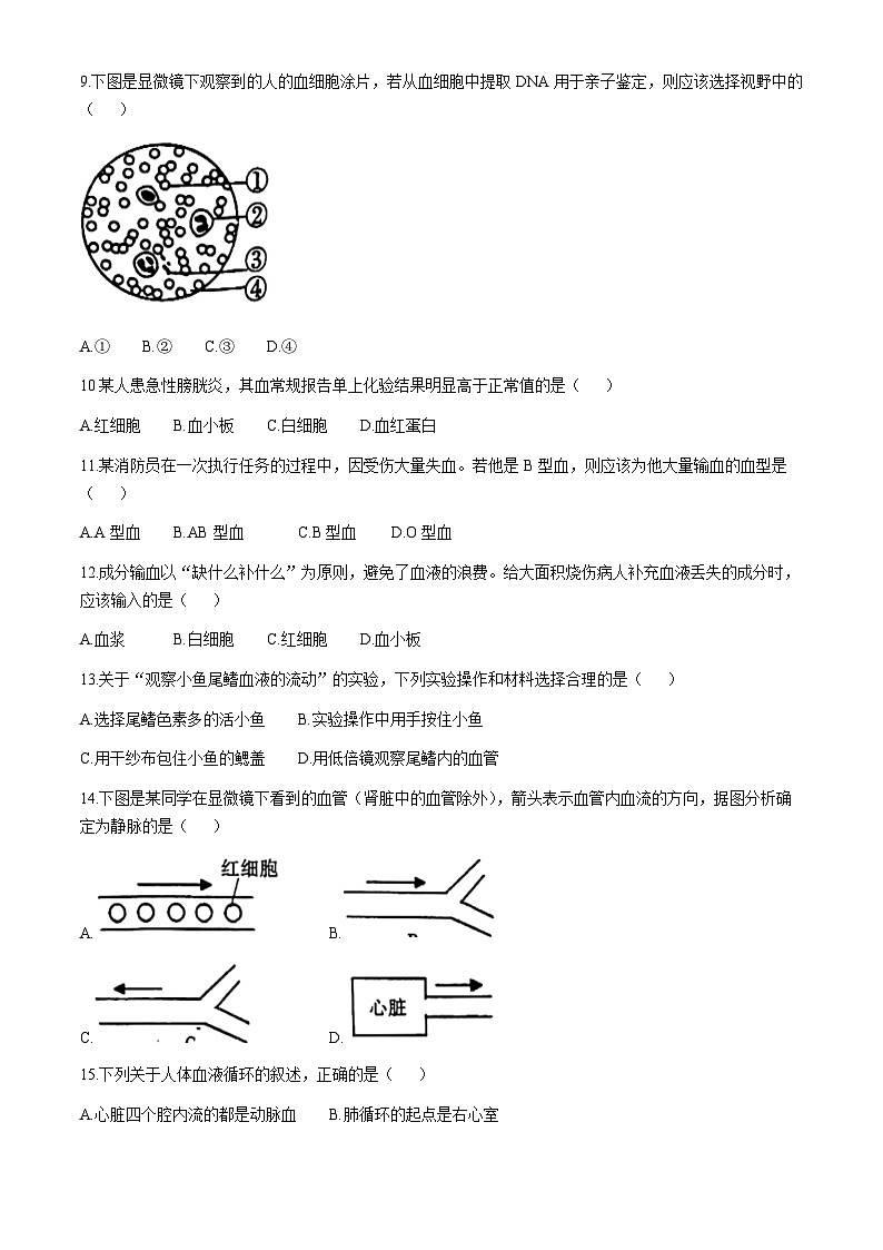 陕西省延安市吴起县三校联考2024-2025学年八年级上学期9月月考生物试题(无答案)第2页