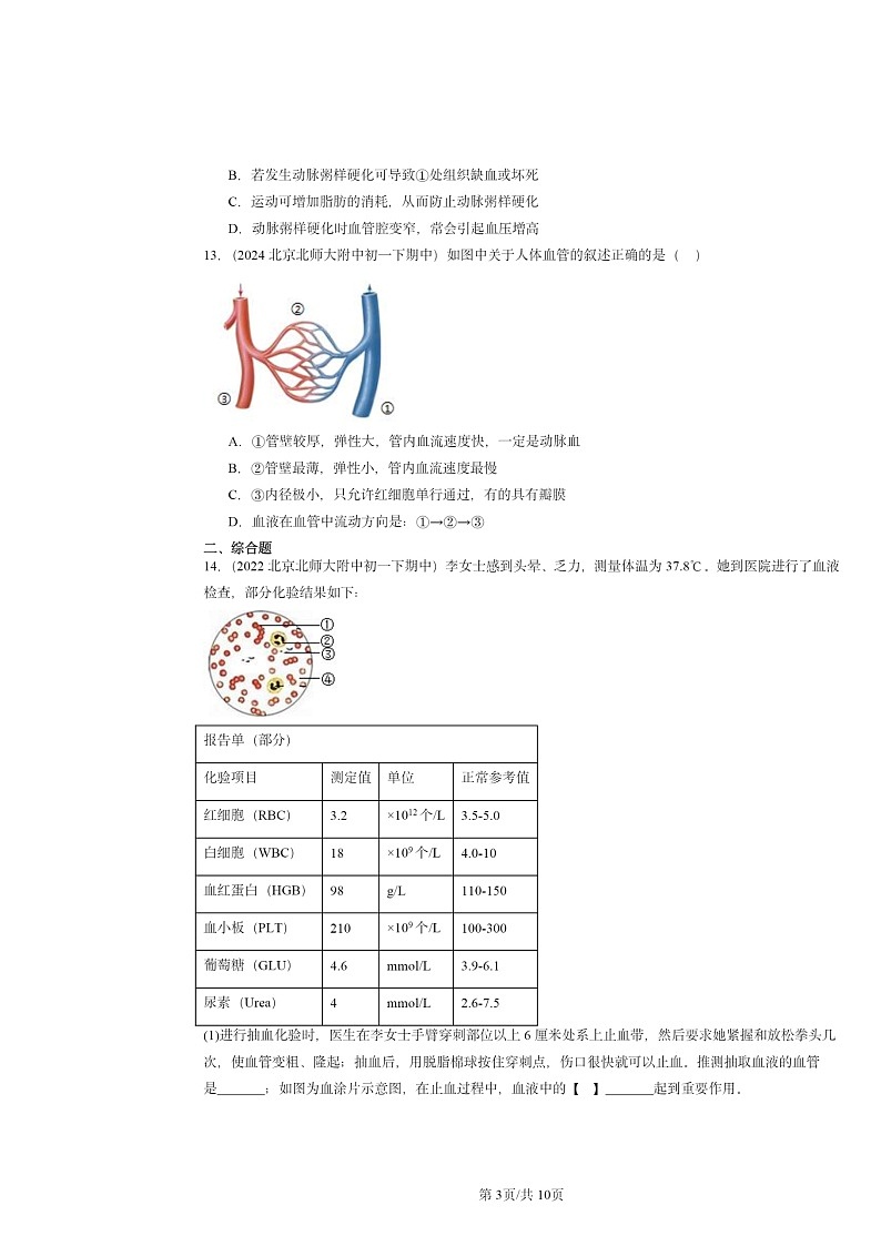 2022～2024北京重点校初一下学期期中真题生物分类汇编：血流的管道──血管第3页