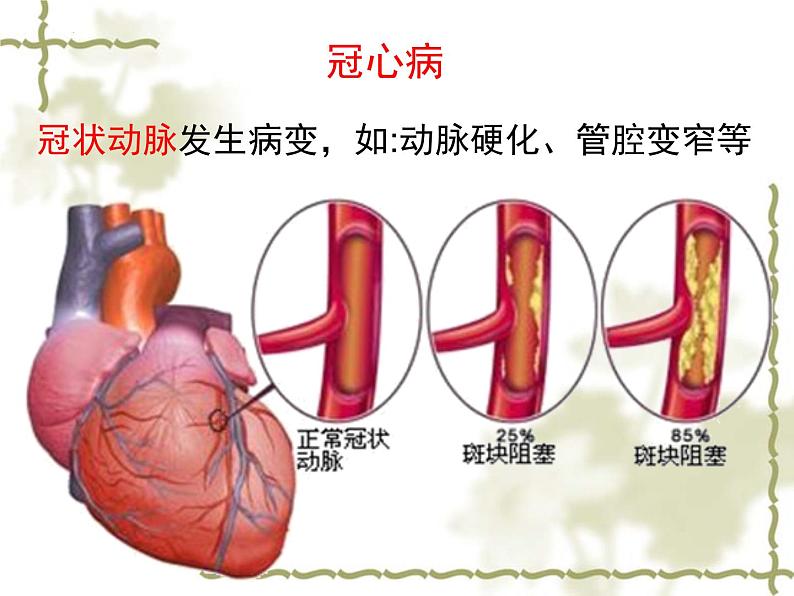 3.3.4关注心血管健康课件-2023-2024学年济南版生物七年级下册第7页