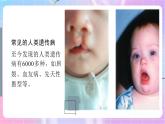 4.4.5人类优生与基因组计划 课件-济南版生物八年级上册